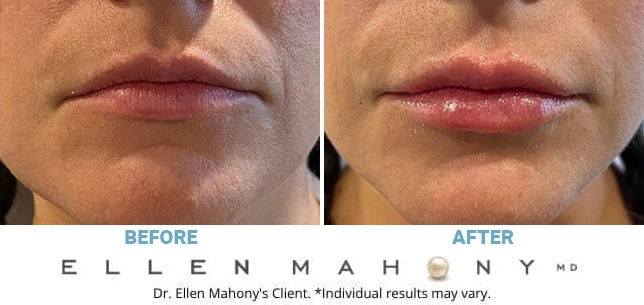 Before and After Image: Case #10519 - front