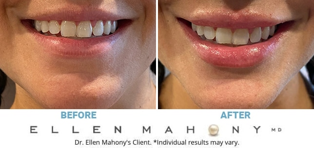 Before and After Image: Case #10519 - front