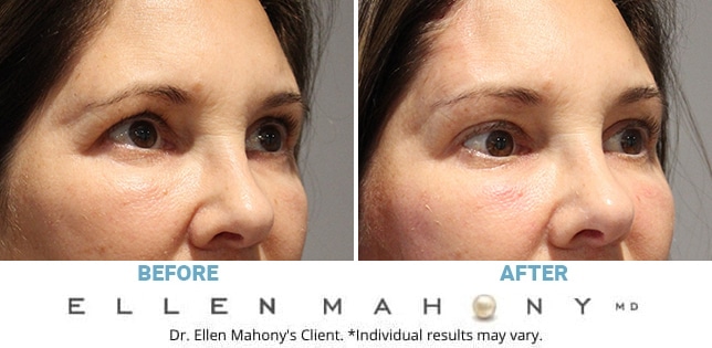 Before and After Image: Case #11186 - right-front-oblique