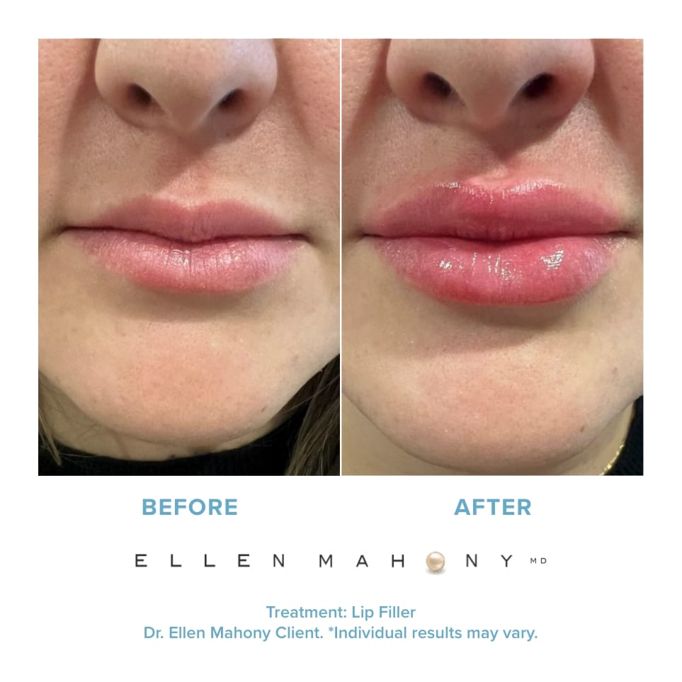 Before and After Image: Case #20918 - front