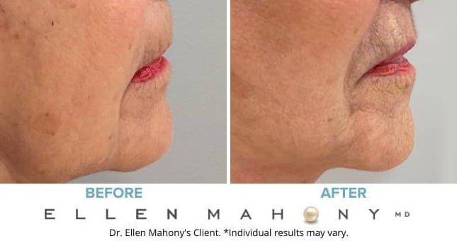 Before and After Image: Case #7130 - right-side