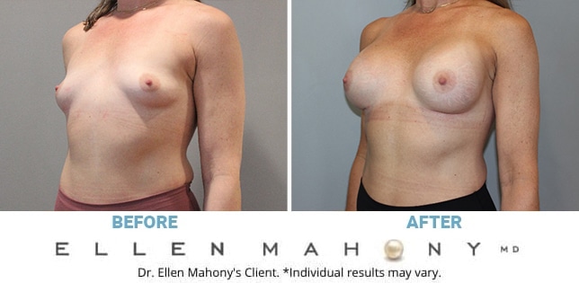 Before and After Image: Case #11730 - left-front-oblique