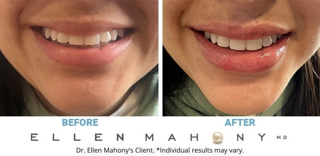 Before and After Image: Case #12210 - front