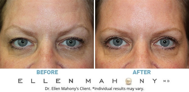 Before and After Image: Case #12450 - front