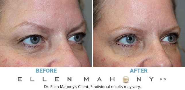 Before and After Image: Case #12450 - right-front-oblique