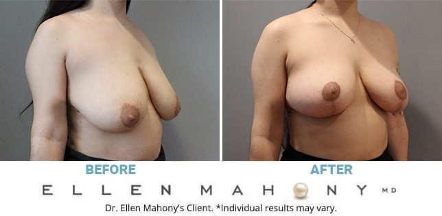 Before and After Image: Case #12366 - right-front-oblique