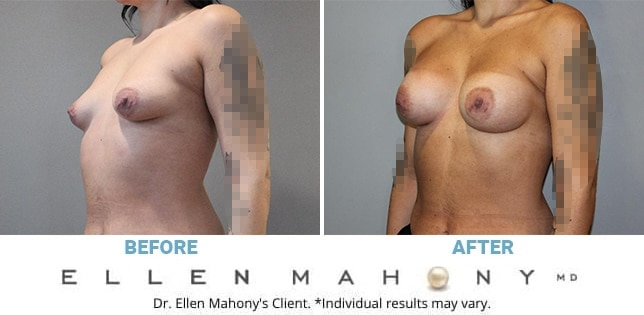 Before and After Image: Case #12388 - left-front-oblique