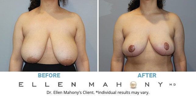 Before and After Image: Case #12296 - front