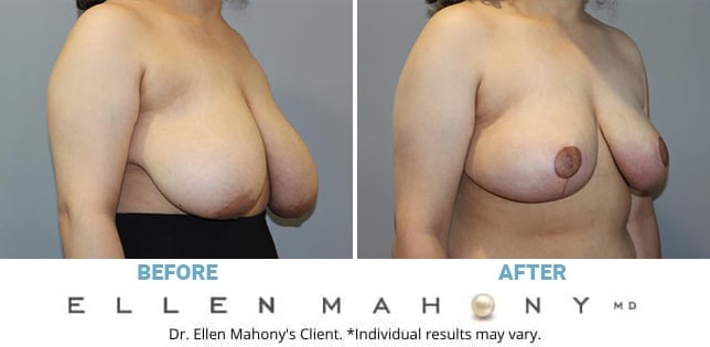 Before and After Image: Case #12296 - right-front-oblique