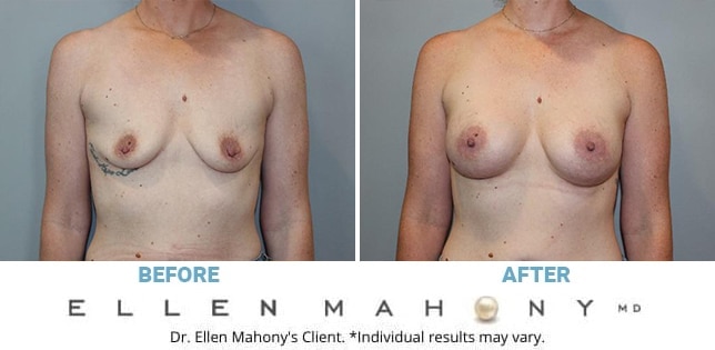 Before and After Image: Case #12672 - front