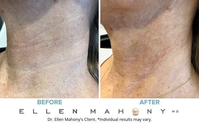 Before and After Image: Case #7727 - left-front-oblique