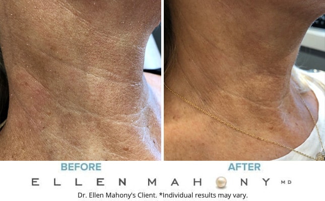 Before and After Image: Case #7727 - right-front-oblique