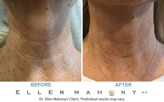 Before and After Image: Case #7727 - front