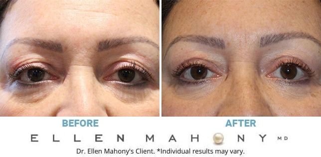 Before and After Image: Case #11968 - front
