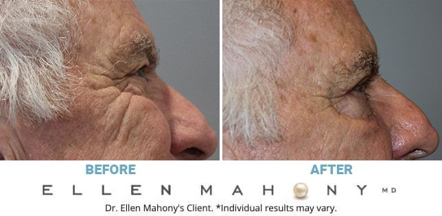Before and After Image: Case #12387 - right-side