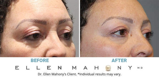 Before and After Image: Case #11968 - right-front-oblique