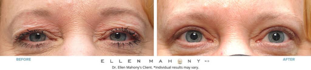 Before and After Image: Case #8196 - front
