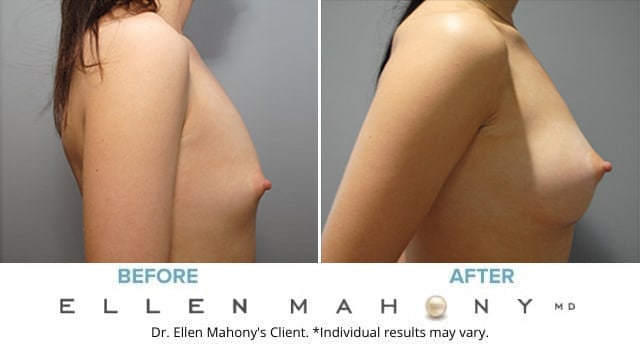 Before and After Image: Case #8560 - right-side