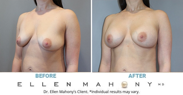 Before and After Image: Case #13216 - left-front-oblique