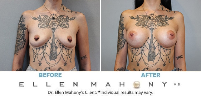 Before and After Image: Case #12899 - front