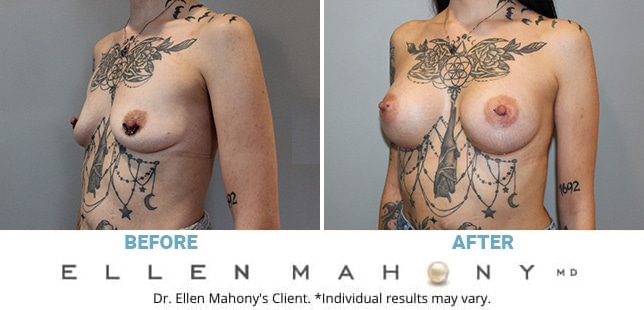 Before and After Image: Case #12899 - left-front-oblique