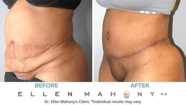 Before and After Image: Case #9967 - left-front-oblique