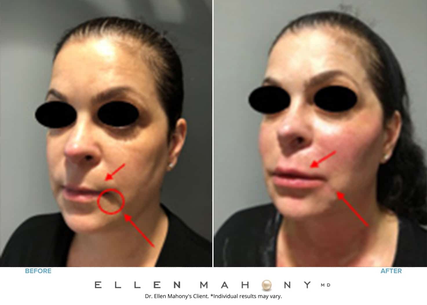Before and After Image: Case #8356 - left-front-oblique