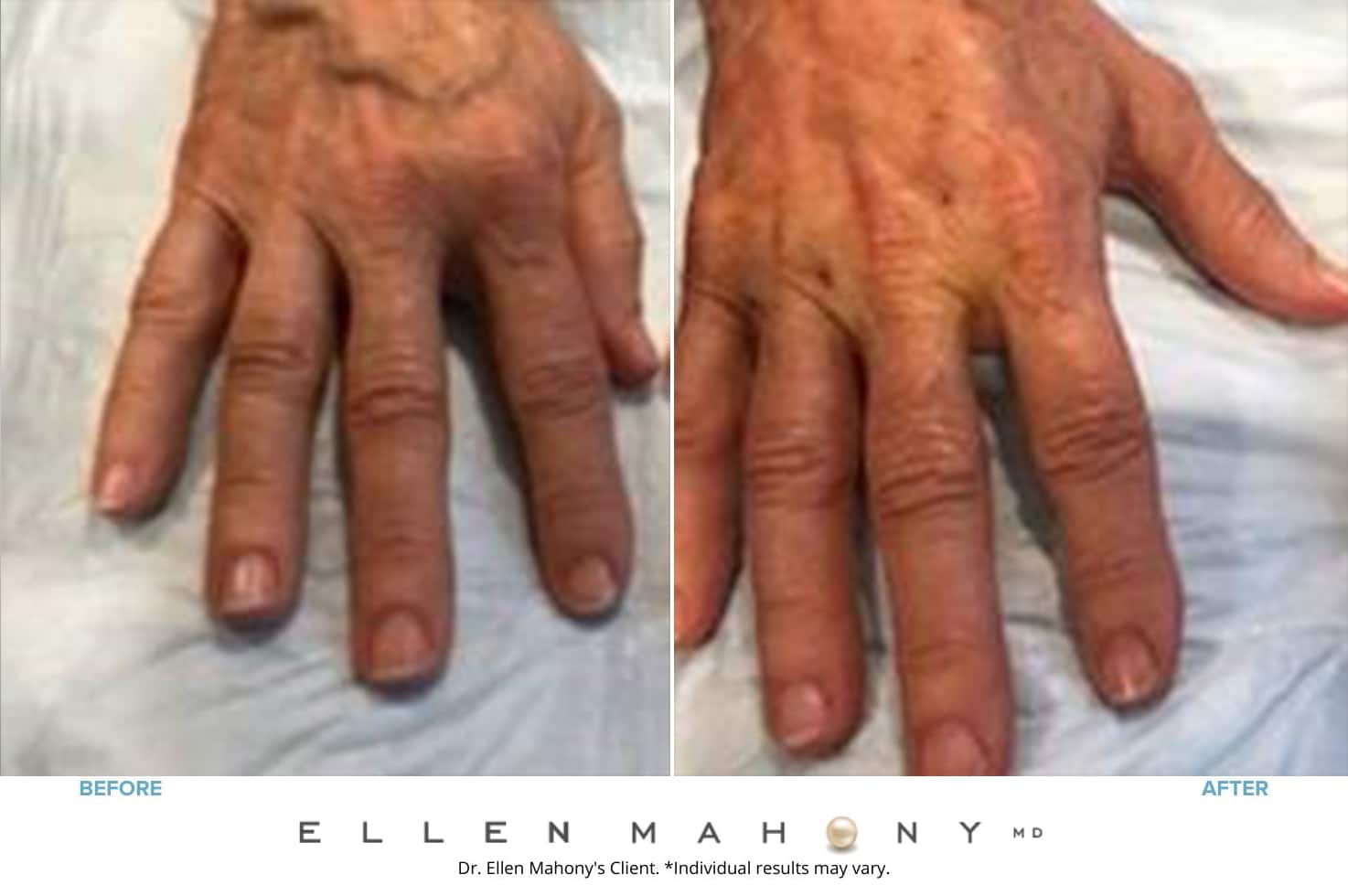 Before and After Image: Case #8531 - front
