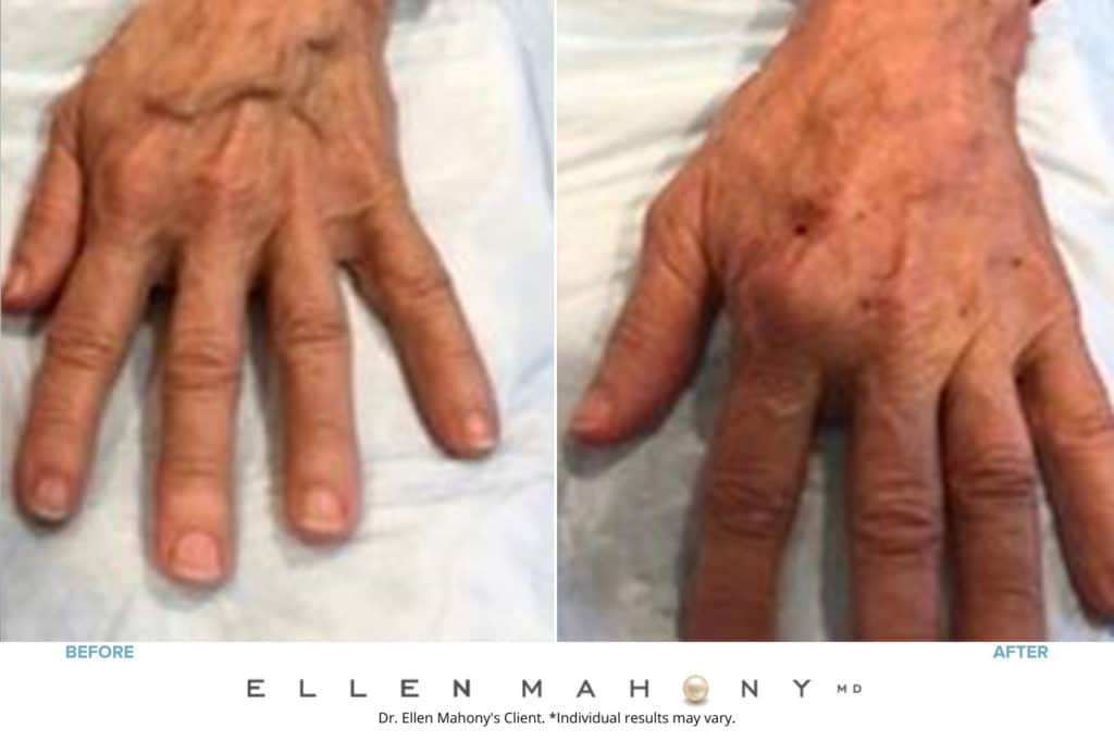 Before and After Image: Case #8531 - front