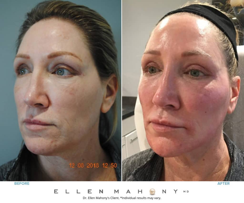 Before and After Image: Case #8602 - left-front-oblique