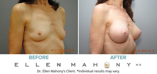 Before and After Image: Case #7840 - right-front-oblique