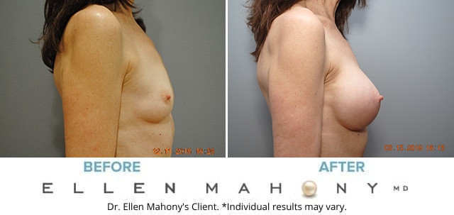Before and After Image: Case #7840 - right-side