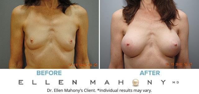 Before and After Image: Case #7840 - front