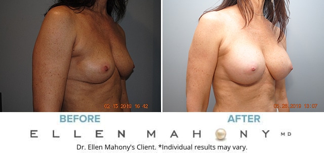 Before and After Image: Case #7856 - right-front-oblique