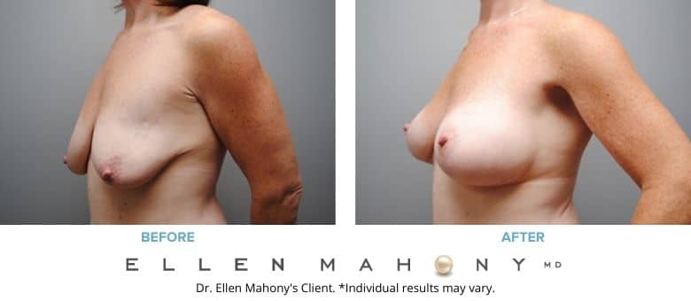 Before and After Image: Case #2758 - left-front-oblique