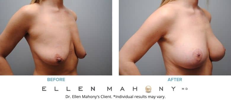 Before and After Image: Case #2772 - right-front-oblique