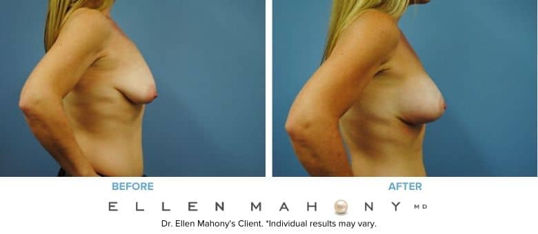Before and After Image: Case #2999 - right-side
