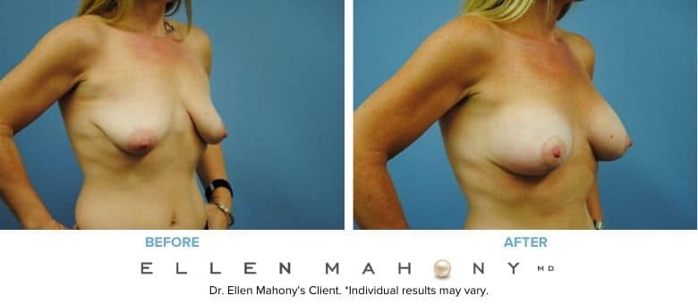 Before and After Image: Case #2999 - right-front-oblique