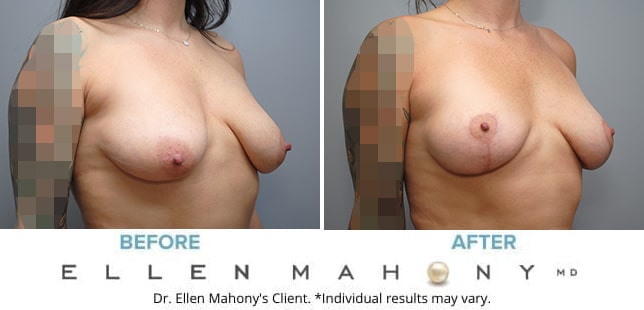Before and After Image: Case #9603 - right-front-oblique