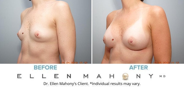 Before and After Image: Case #7976 - left-front-oblique