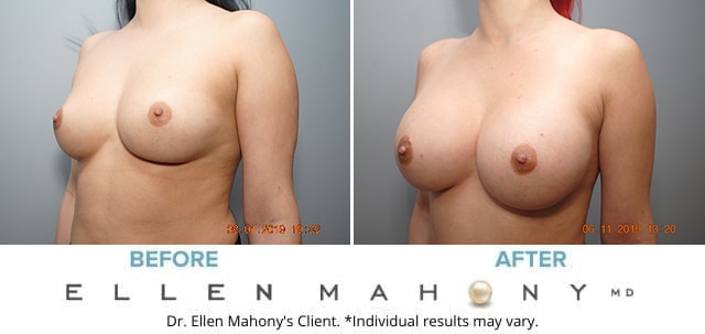 Before and After Image: Case #8062 - left-front-oblique