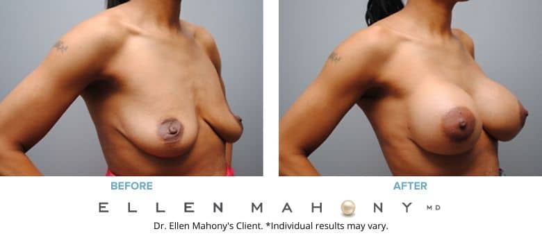 Before and After Image: Case #2779 - right-front-oblique