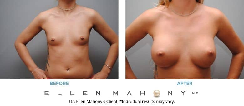 Before and After Image: Case #2786 - front