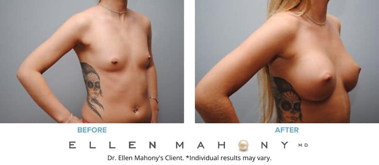 Before and After Image: Case #2786 - right-front-oblique