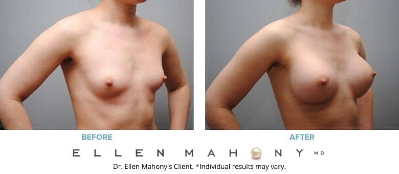 Before and After Image: Case #2793 - right-front-oblique