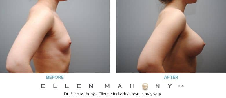 Before and After Image: Case #2793 - right-side