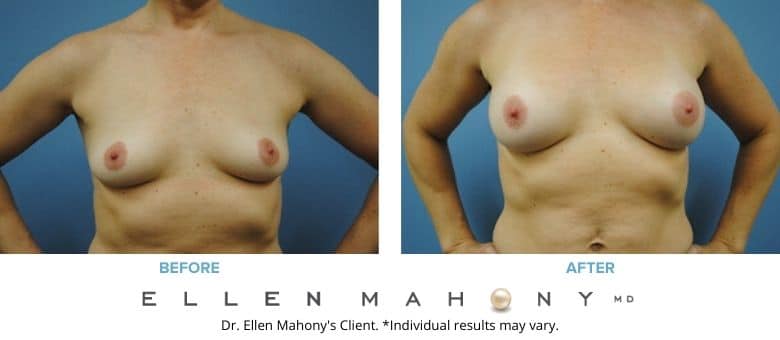 Before and After Image: Case #2800 - front