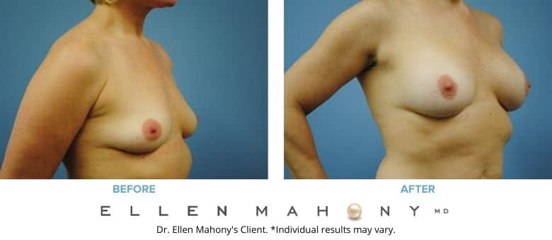Before and After Image: Case #2800 - right-front-oblique