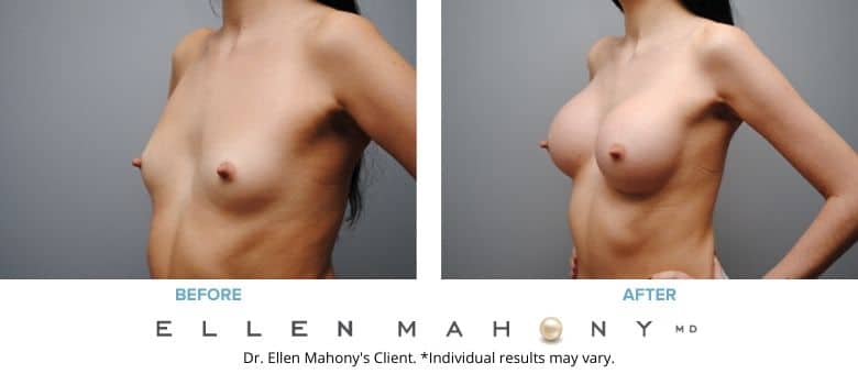 Before and After Image: Case #2807 - left-front-oblique