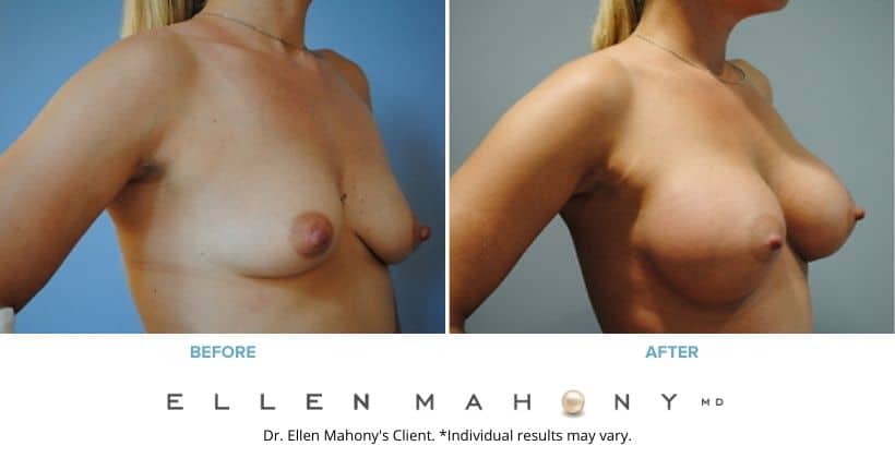 Before and After Image: Case #2826 - right-front-oblique